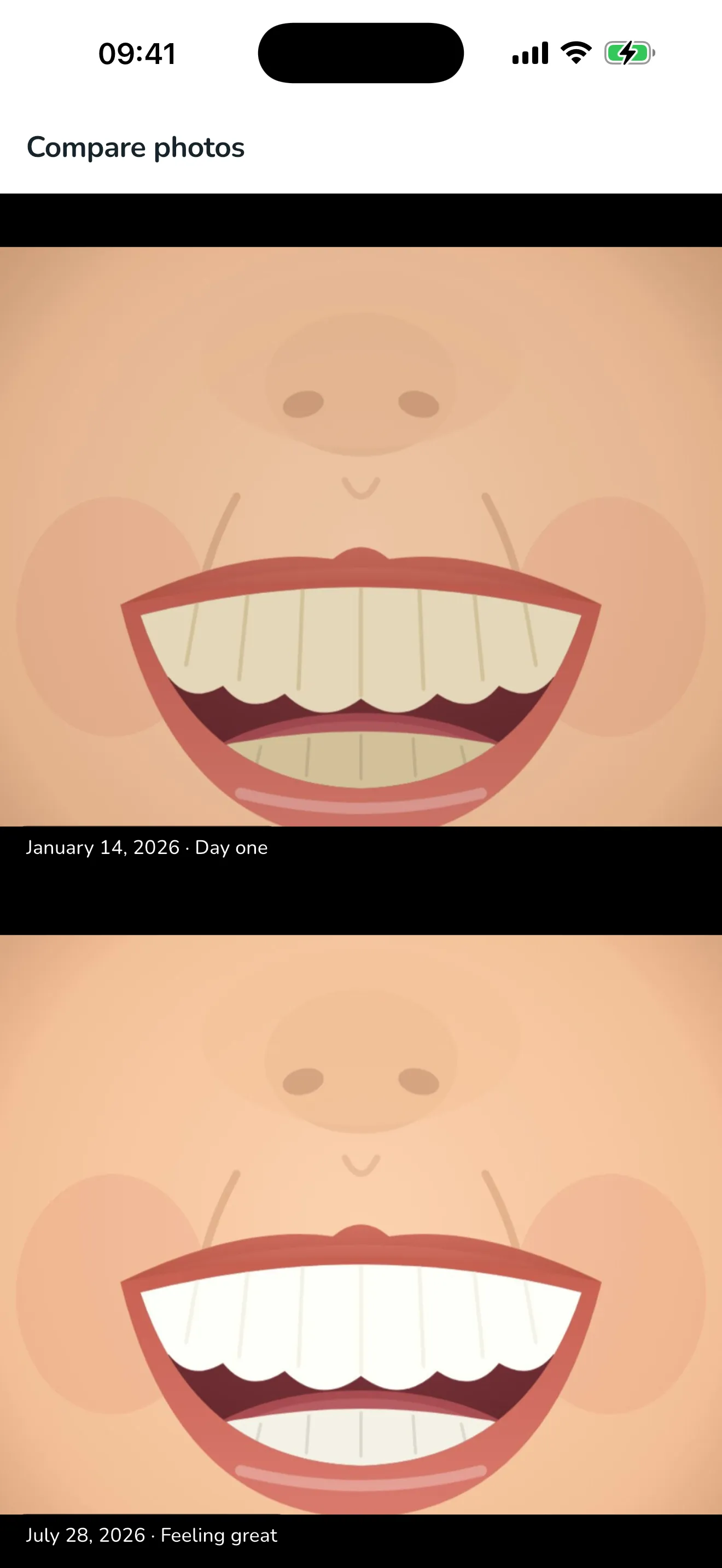 The smile timeline, with two photos of the same smile set one above the other