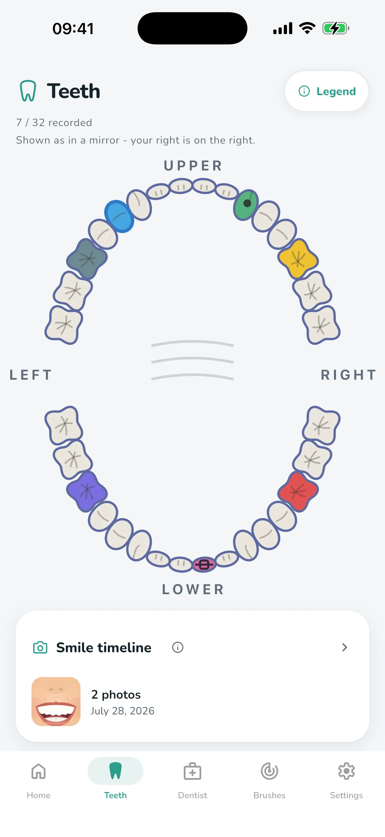 The Teeth tab: a 32-tooth map with 7 teeth recorded in colour