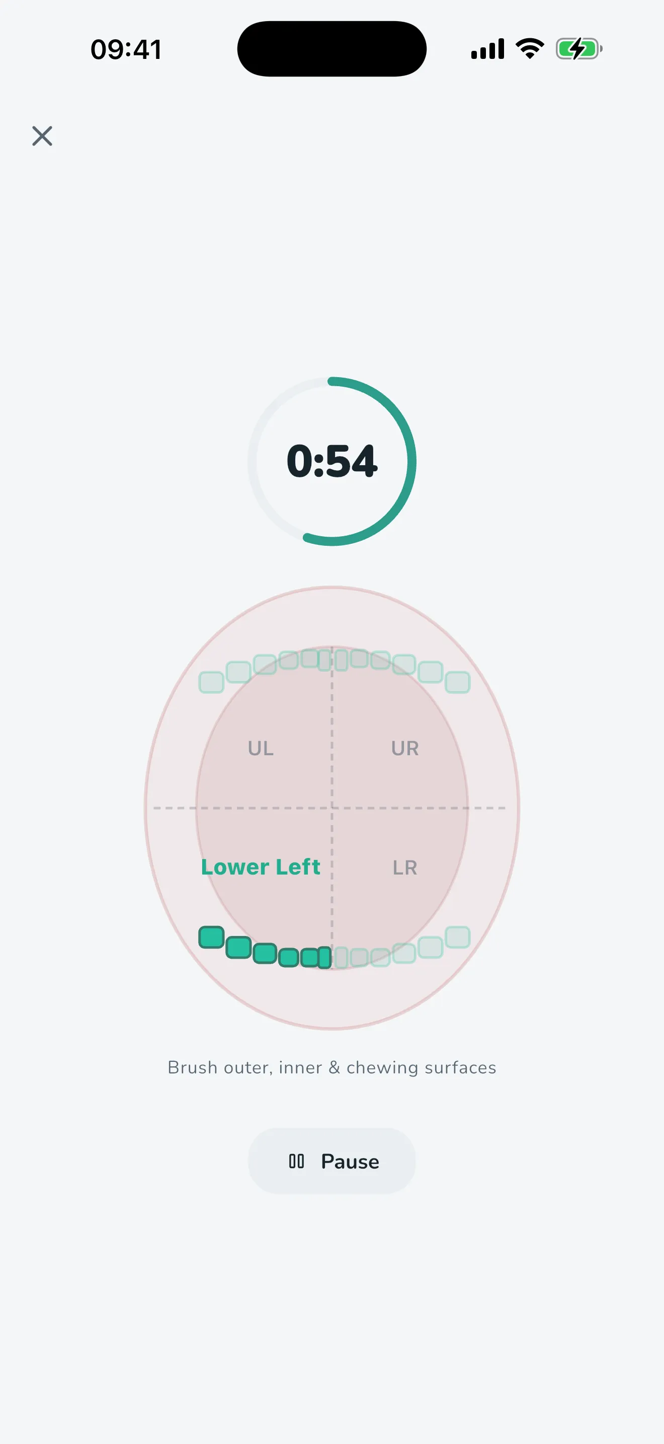 The brushing timer at 0:54, with the lower left quadrant highlighted